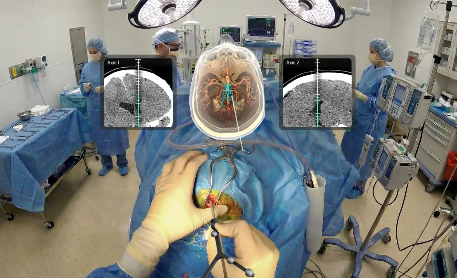 واقعیت افزوده در جراحی مغز و اعصاب، Medivis مجوز FDA گرفت واقعیت افزوده در جراحی مغز و اعصاب، Medivis مجوز FDA گرفت